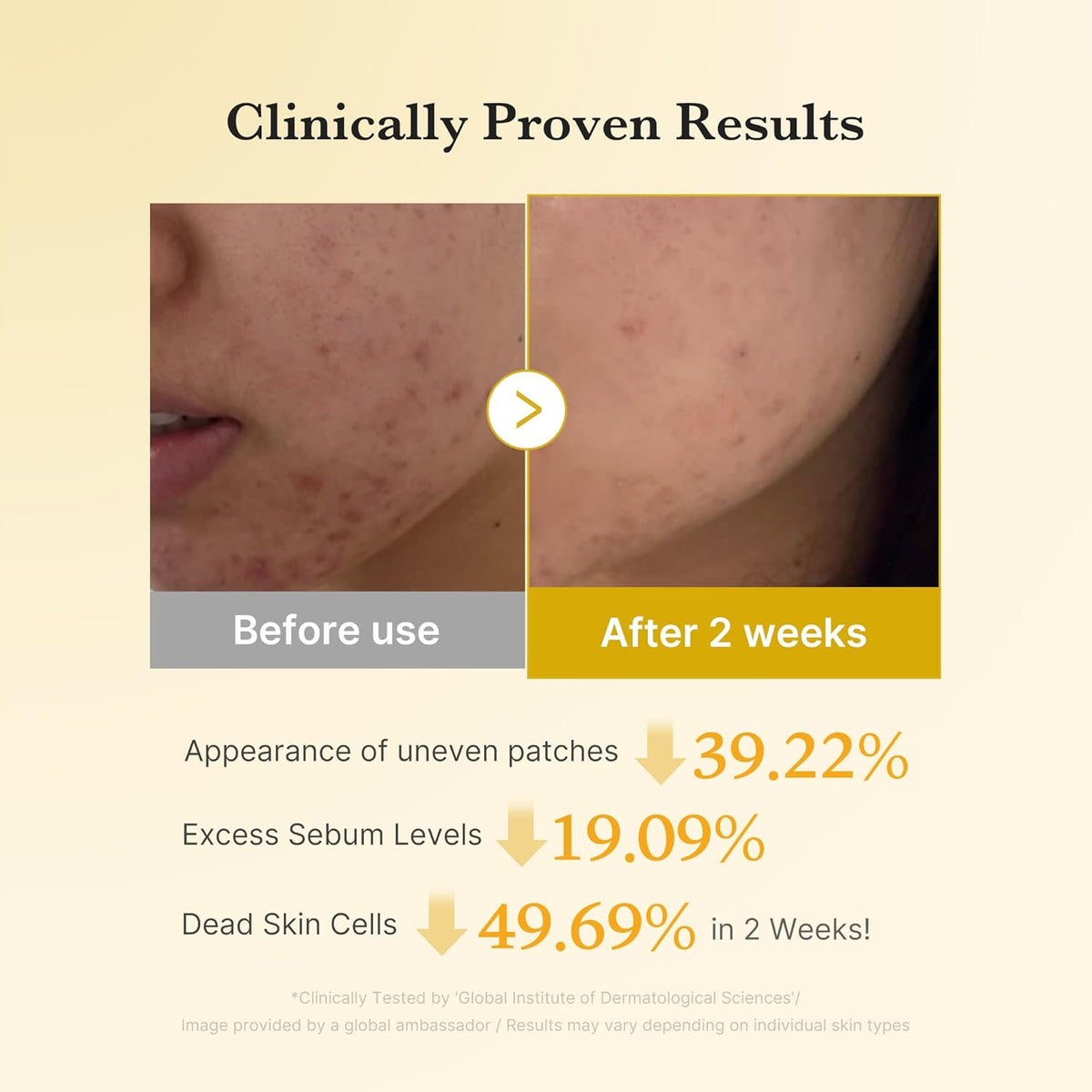 Kojic Acid Renew & Smooth Duo - Kojic Acid Serum and Toner Pad | Kojic Acid Turmeric Clarifying Toner Pad and Capsule Serum for Brightening and Balancing Skin Tone and Texture